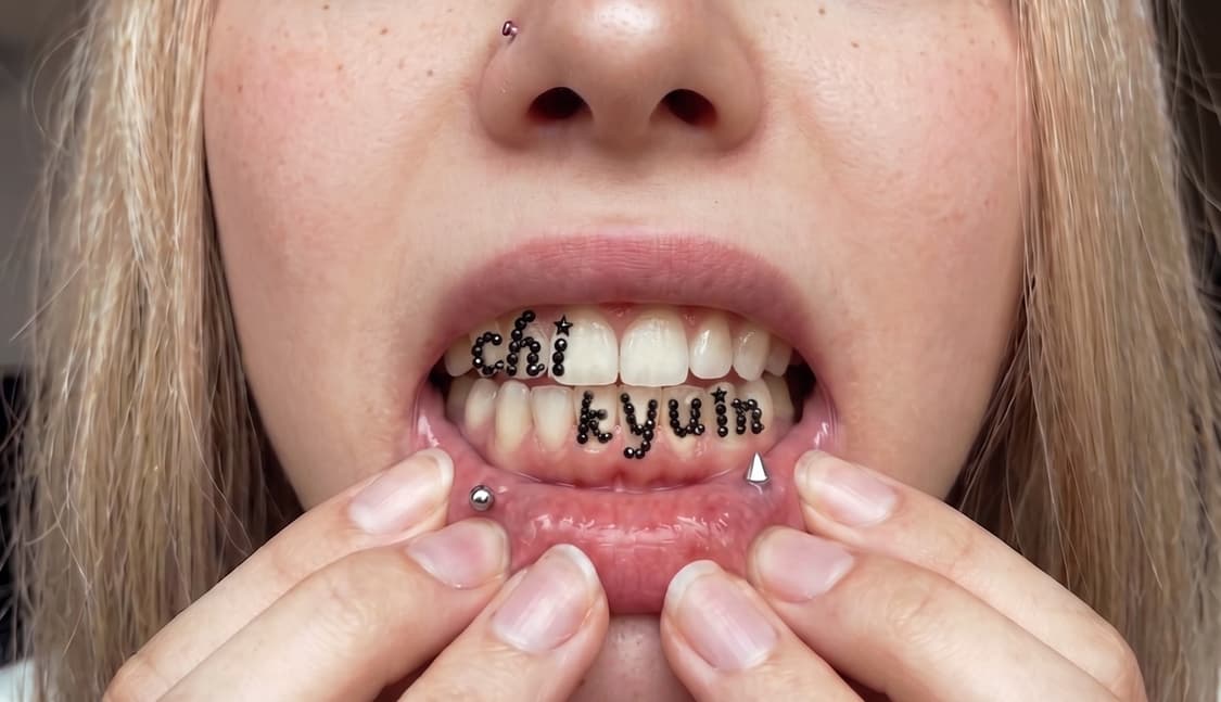 cover-image