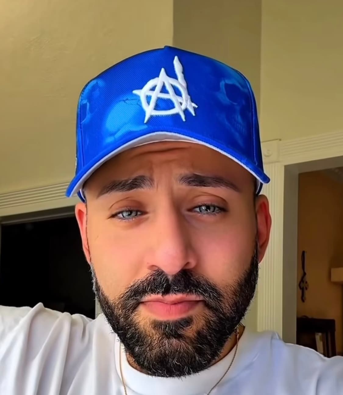 크리스브라운 KILL THE HYPE 킬더하이프 LA 스컬 아나키 스냅백 상품이미지7