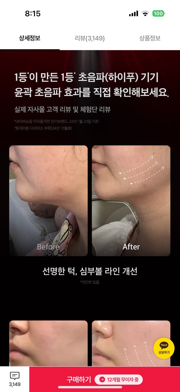 미개봉/ 메디큐브 하이포커스샷 상품이미지3