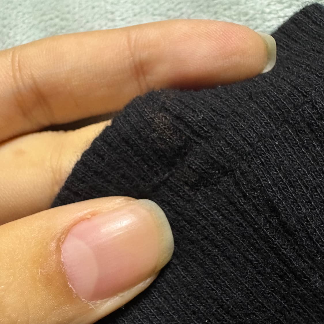 허그유어스킨 허유스 스트라이프 스냅 버튼 후드 티셔츠 상품이미지2