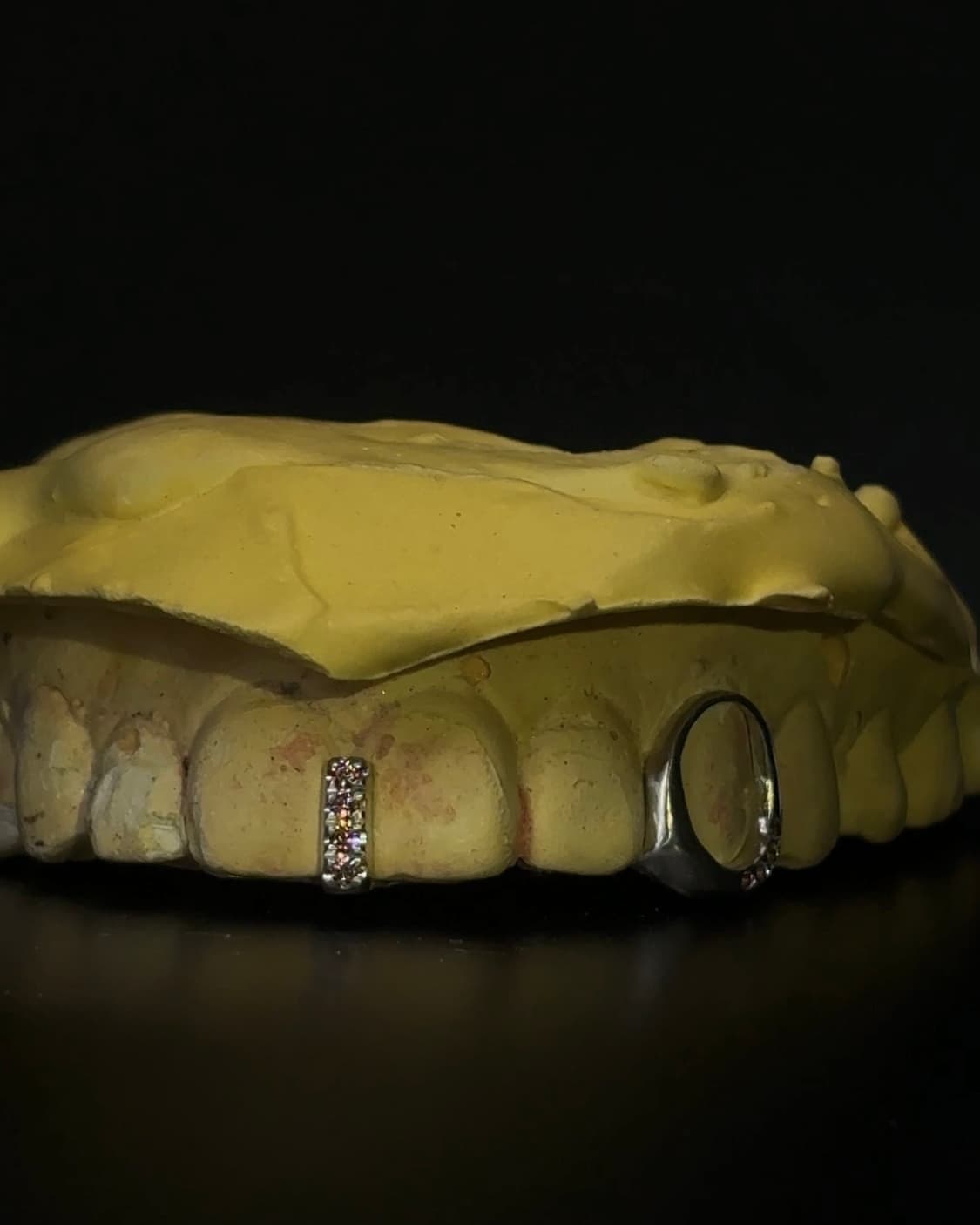 그릴즈 grillz 상품이미지1