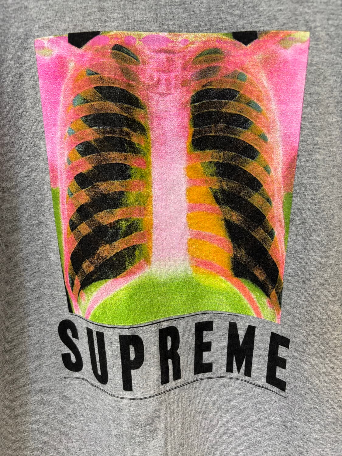 Supreme “X-ray” 상품이미지2