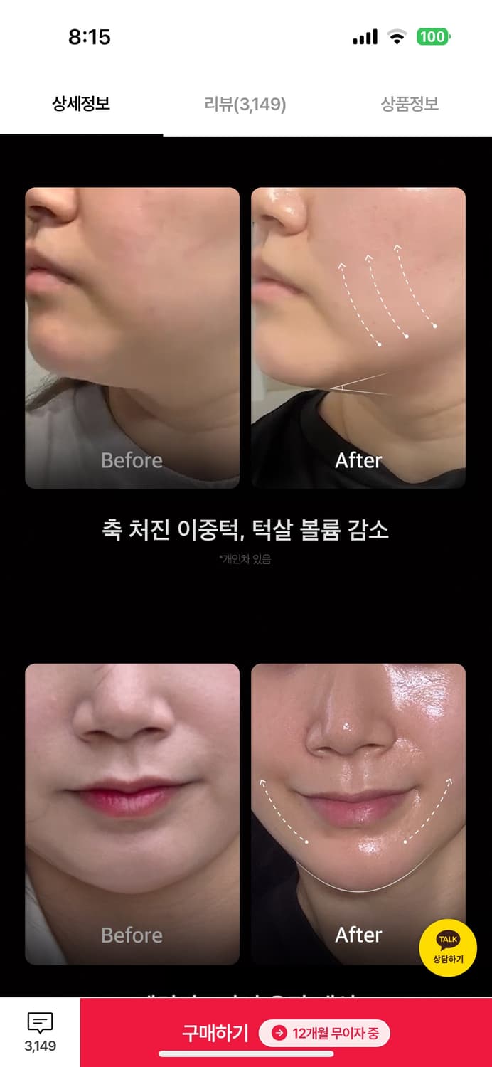미개봉/ 메디큐브 하이포커스샷 상품이미지4