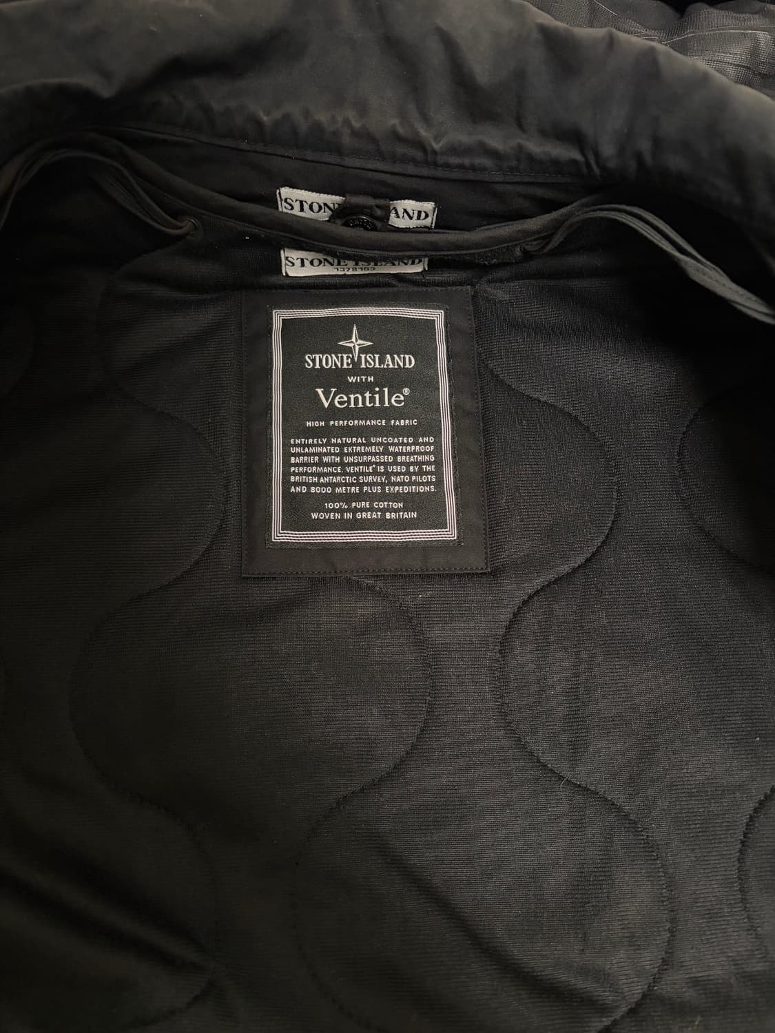 스톤아일랜드 벤틸 트렌치코트 상품이미지2