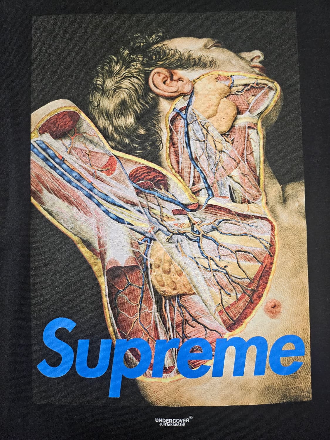 슈프림 언더커버 16FW 아나토미 해부 반팔 블랙 상품이미지5