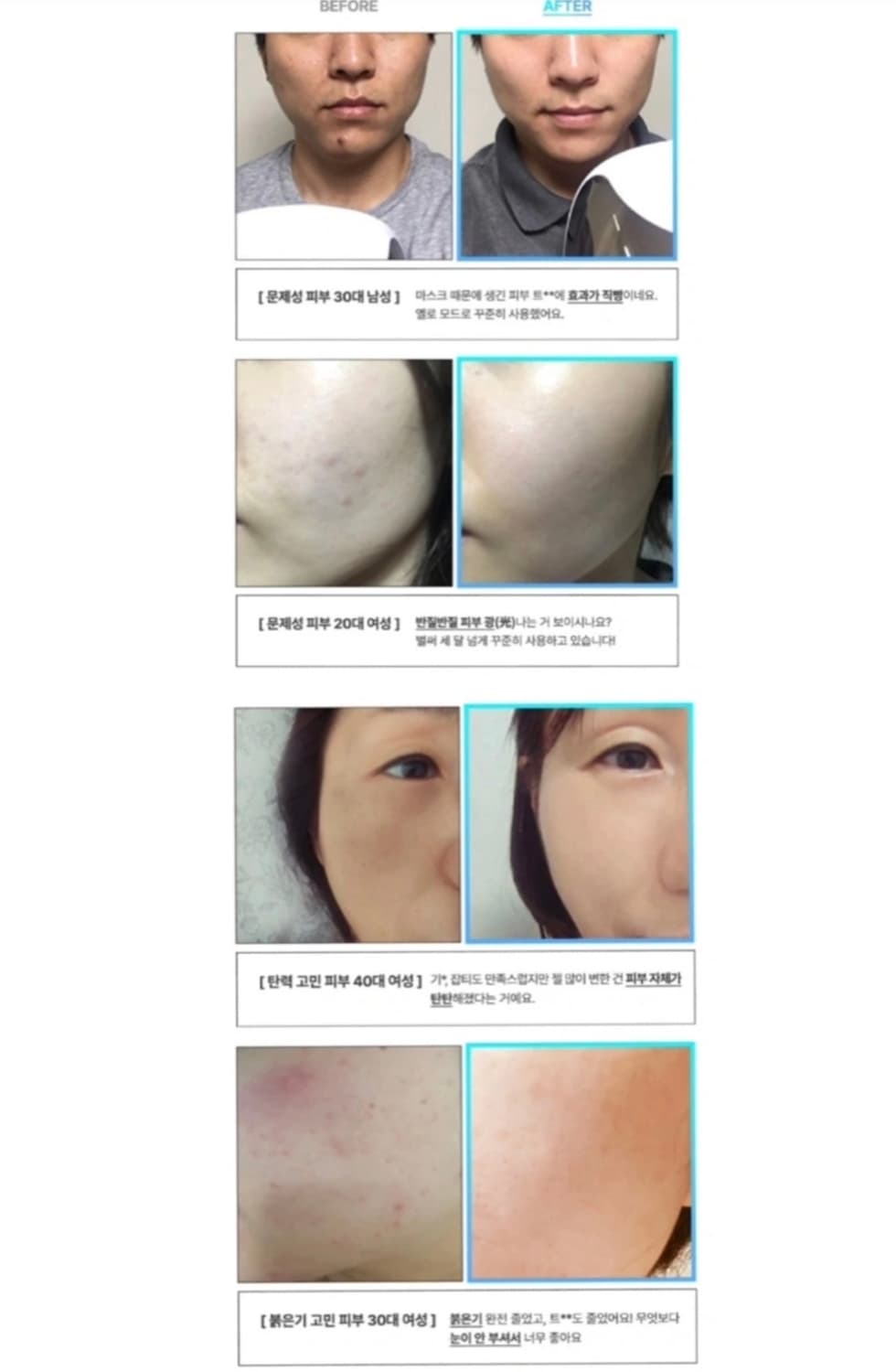 큐리케어)하루 LED 마스크 상품이미지6