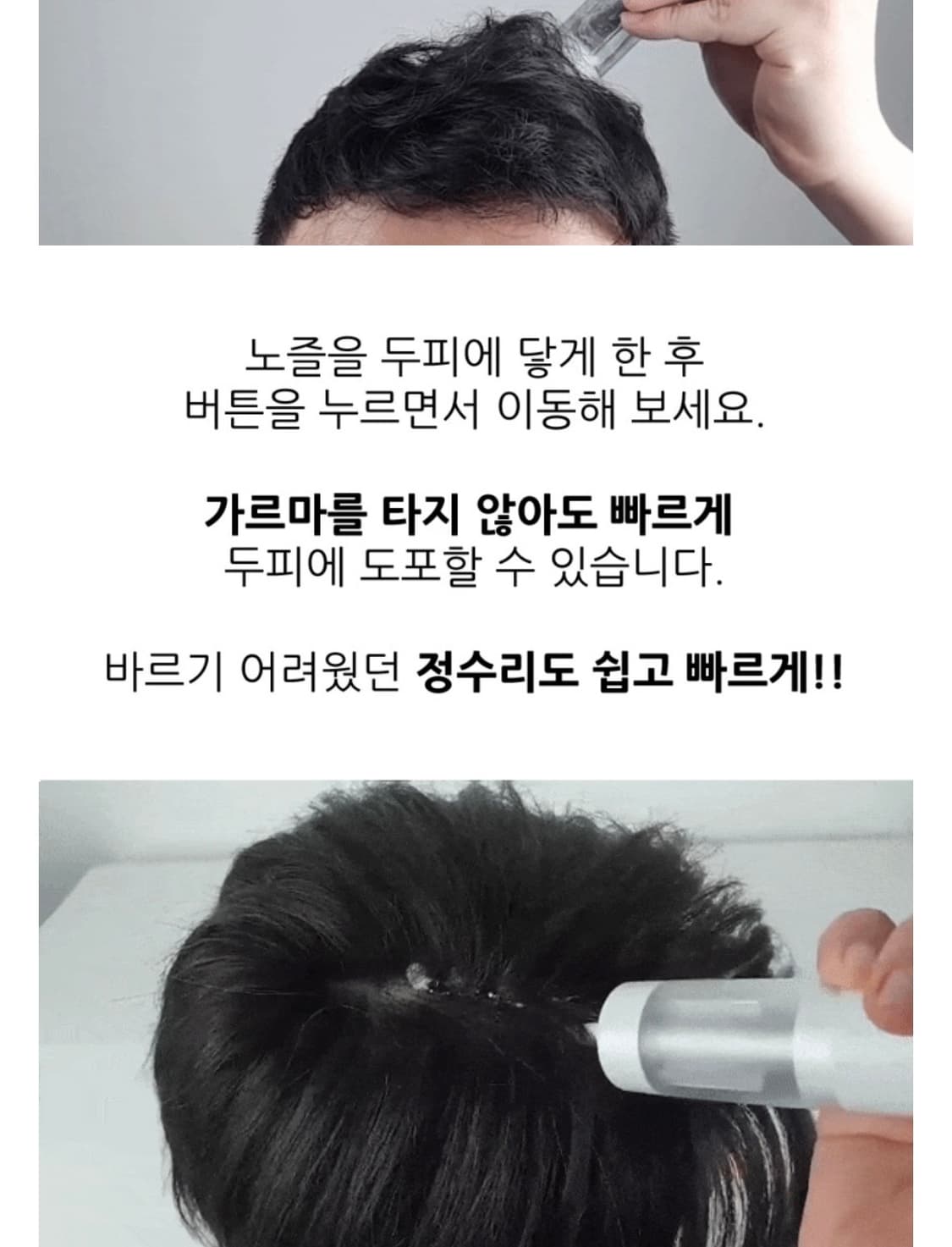 로게인폼/미녹시딜 폼 도포기 상품이미지4