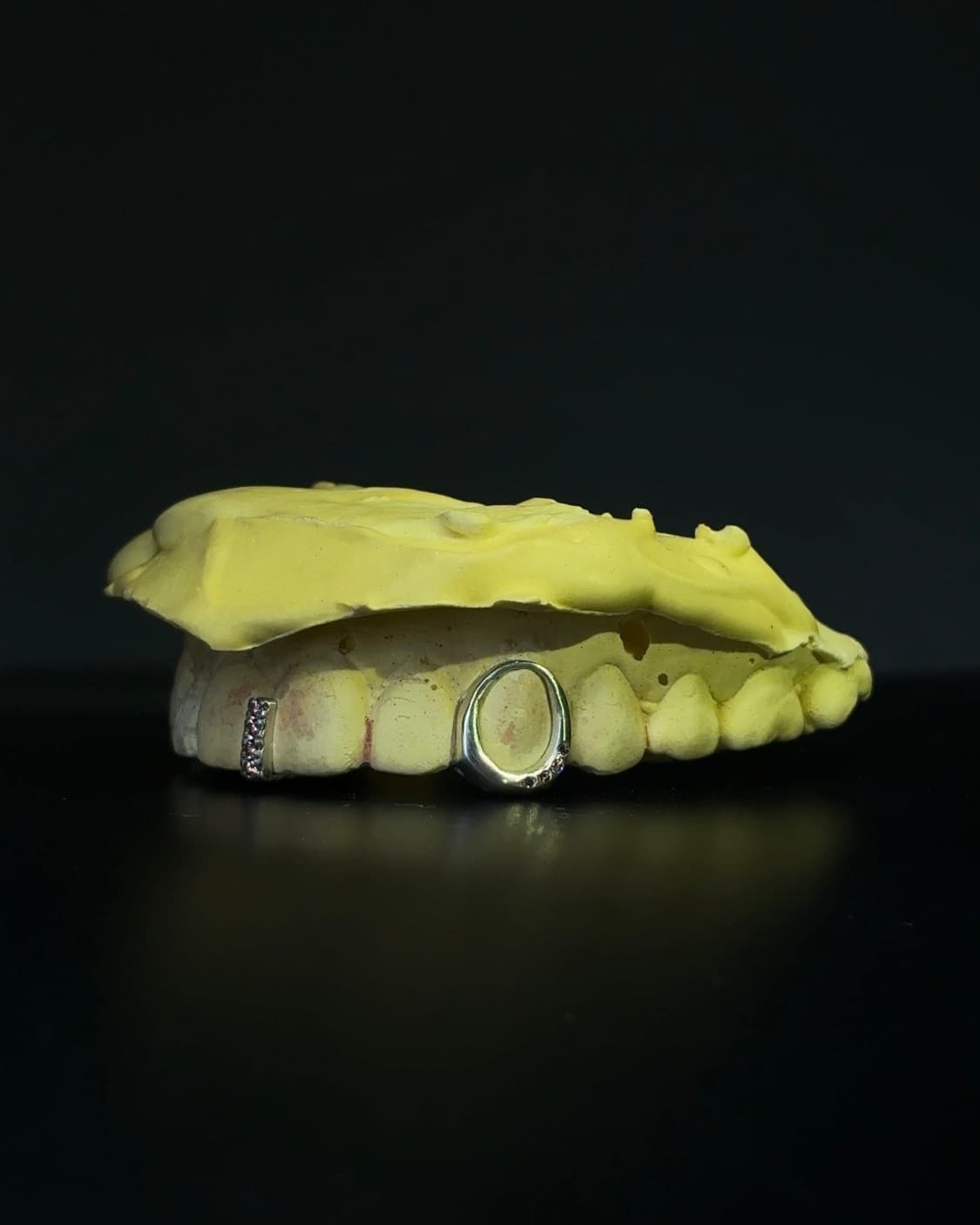 그릴즈 grillz 상품이미지2