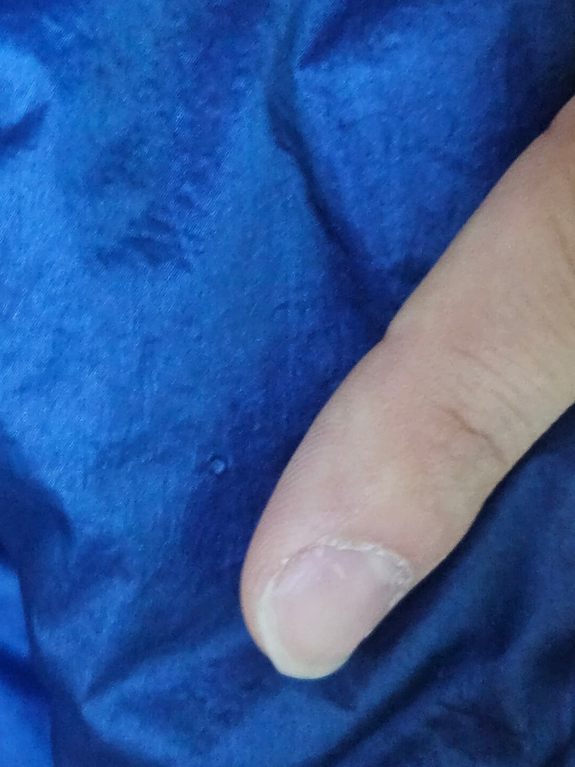 정품 스톤아일랜드 가먼트 다이드 패딩 자켓 L 상품이미지2