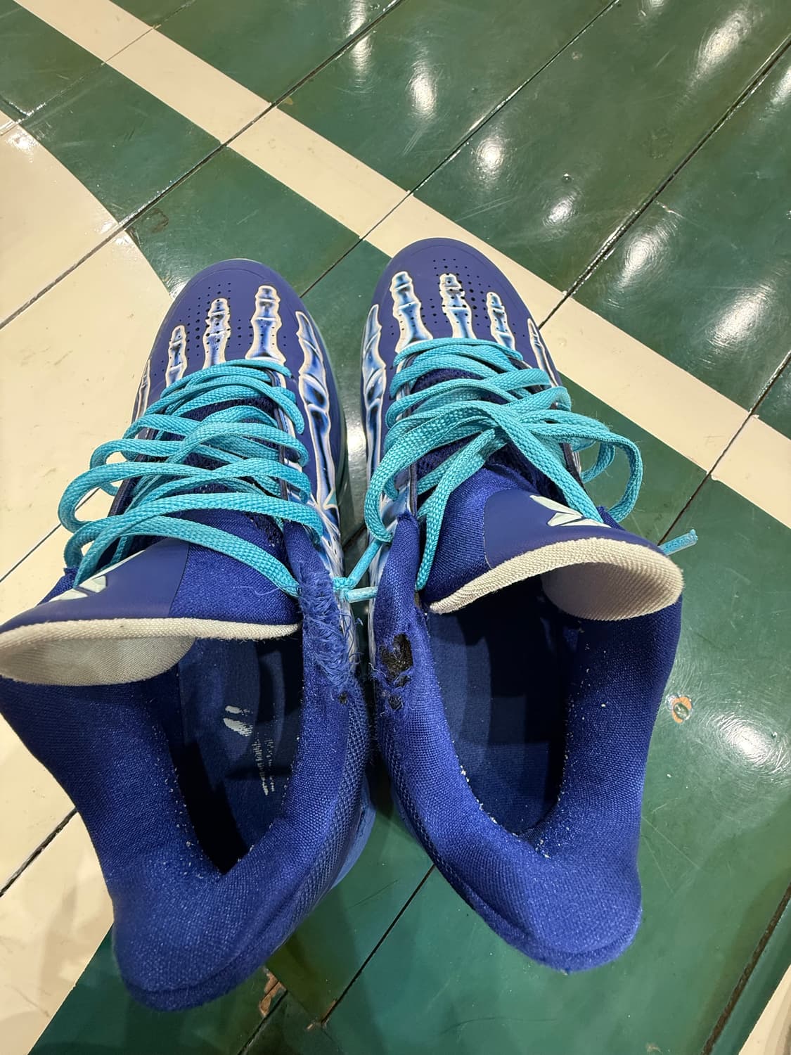 코비 5 엑스레이  상품이미지2