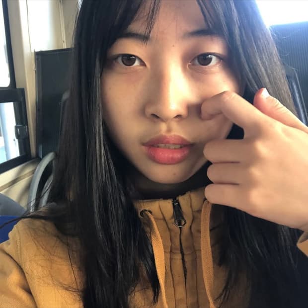 ㅎㄷ
