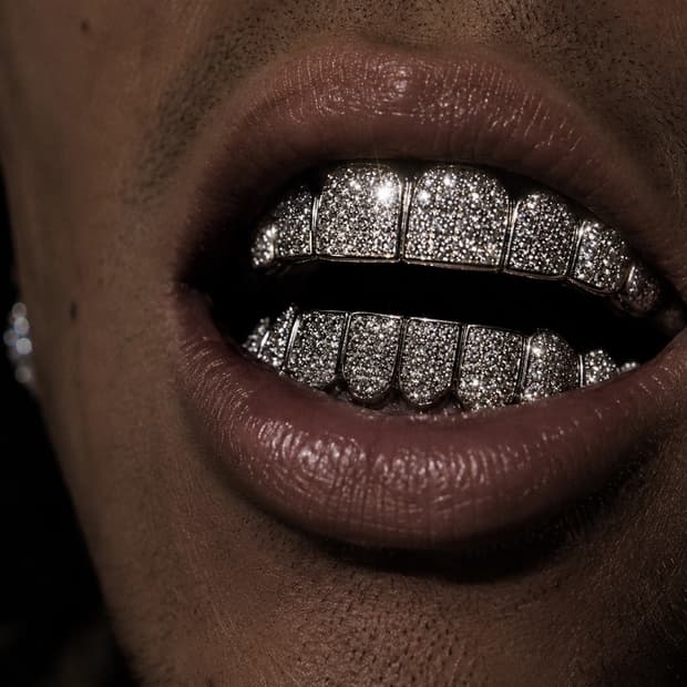 Diamond Dust Grillz