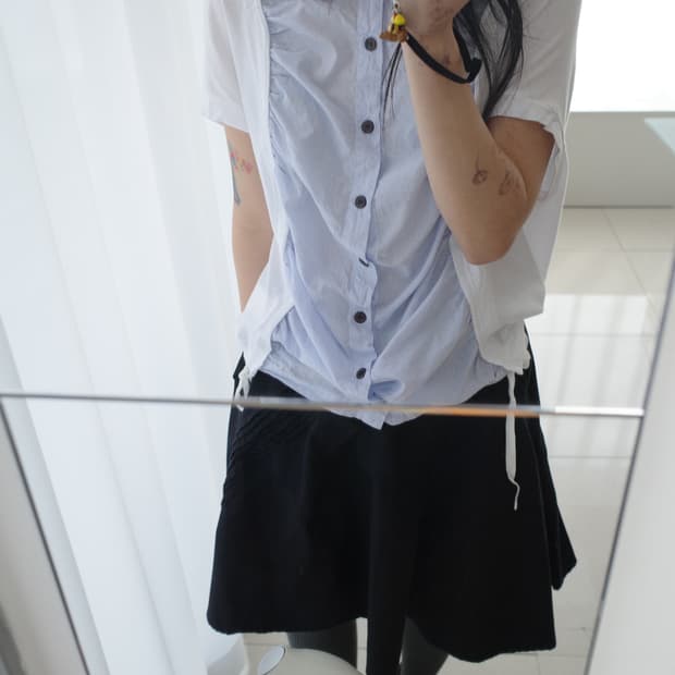 Transformed button top