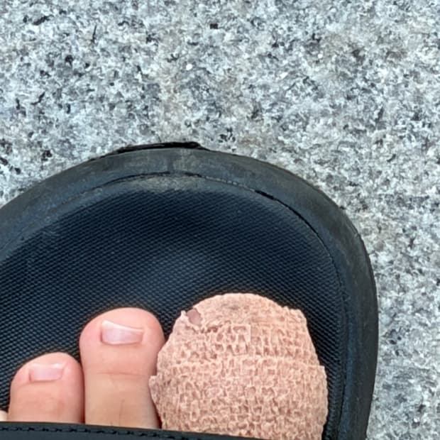 11년산 발가락