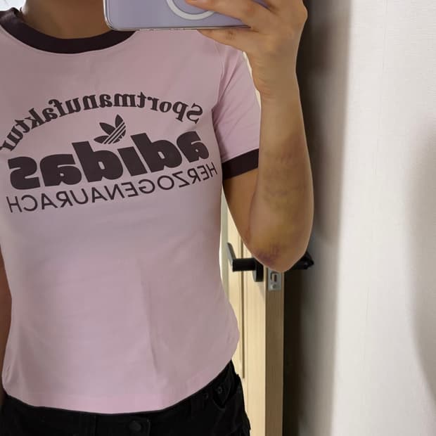 아디다스 반팔 링거티