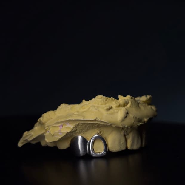 그릴즈 grillz