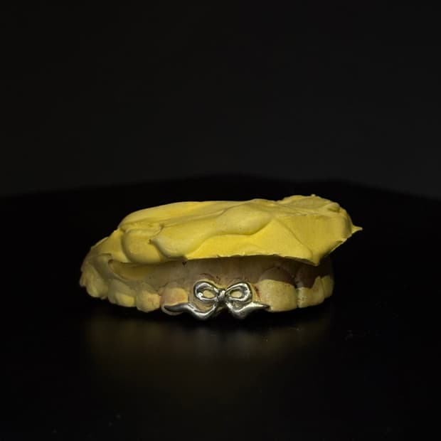 그릴즈 grillz