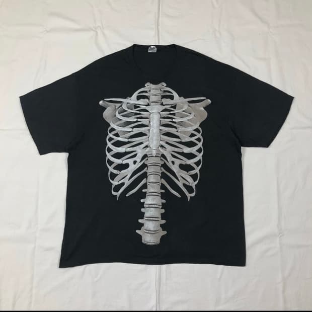 90년도 bone 본 엑스레이 프린트
